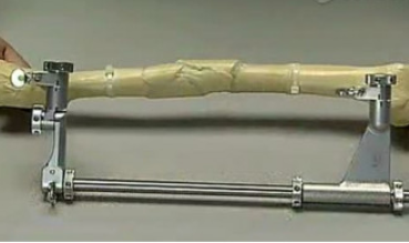 股骨頭微創(chuàng)手術(shù)器械富樂(lè)